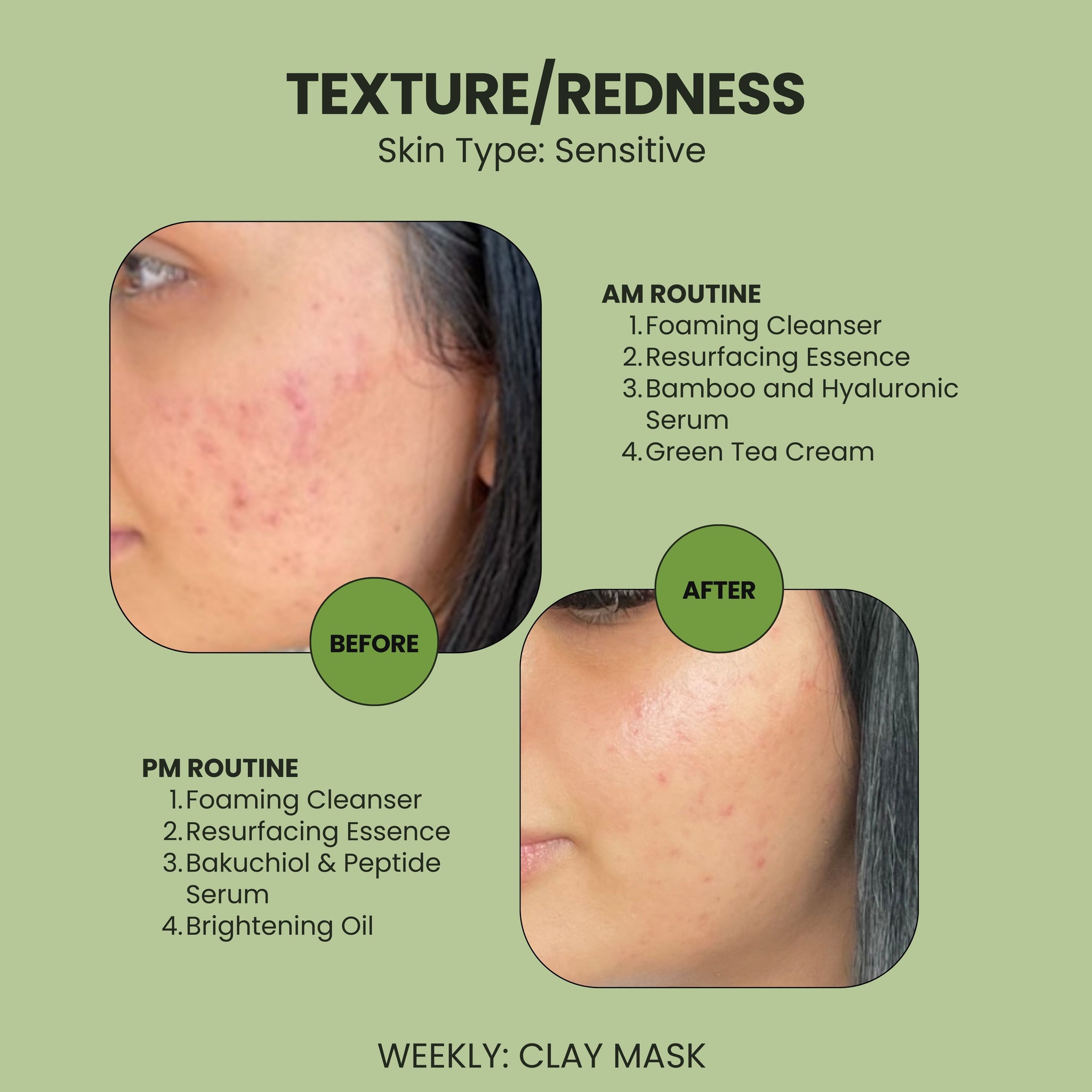 Bakuchiol and Peptide Serum