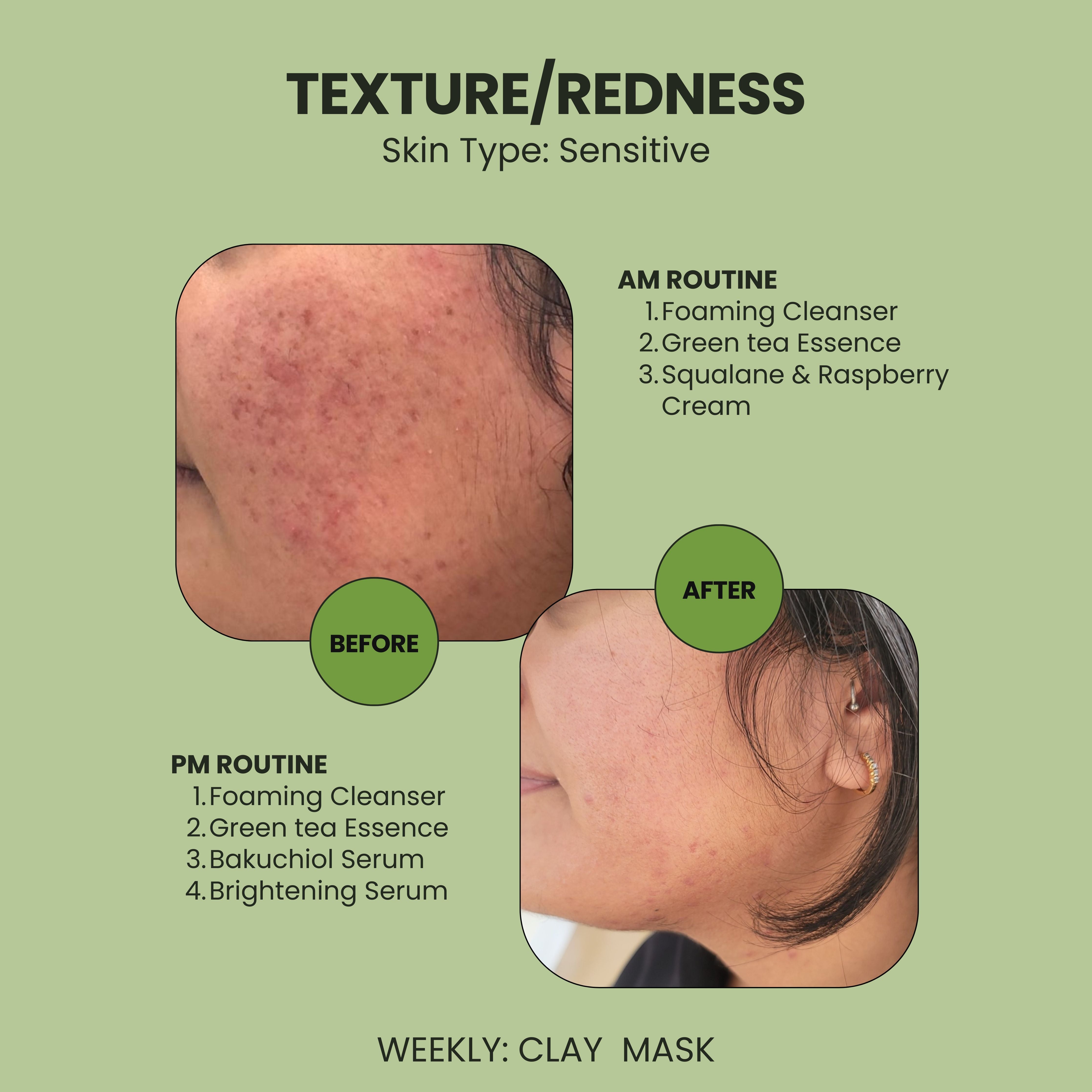 Bakuchiol and Peptide Serum