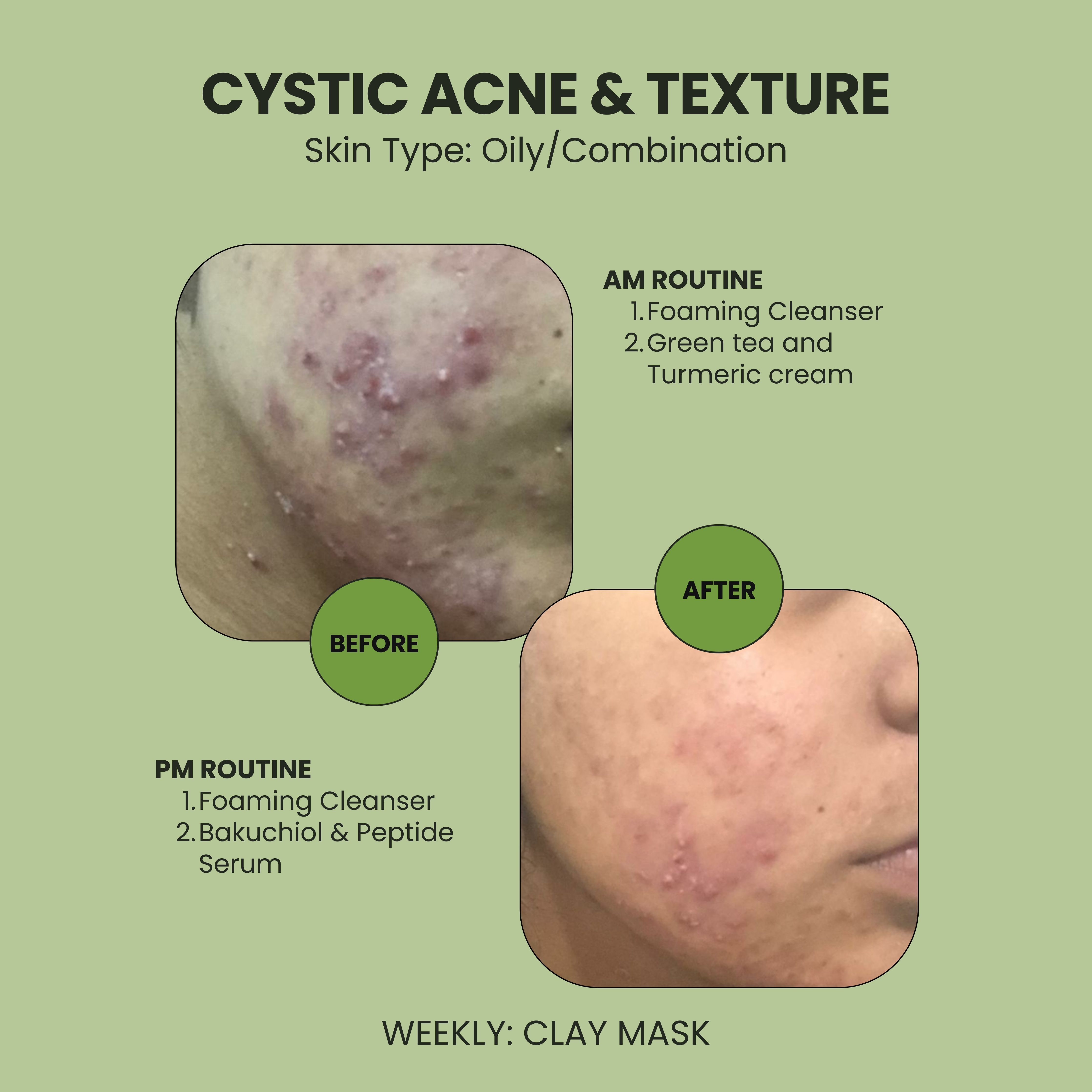 Bakuchiol and Peptide Serum