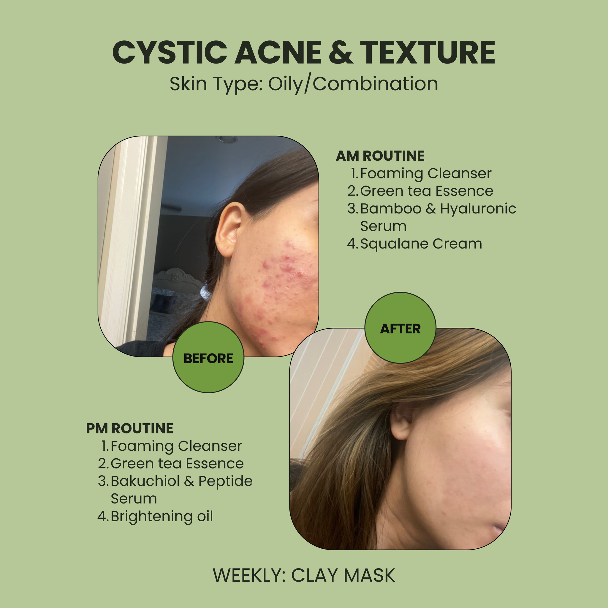 Bakuchiol and Peptide Serum