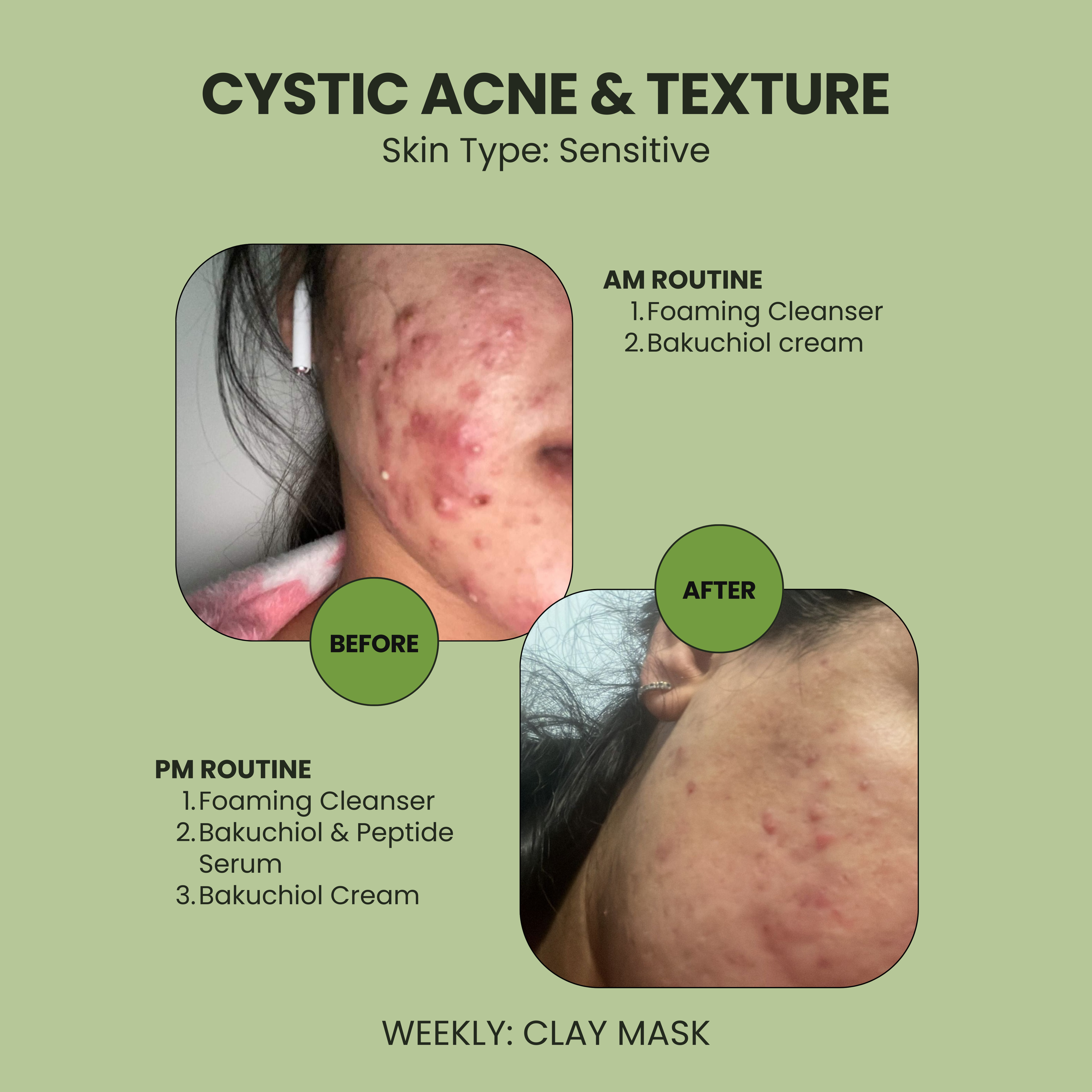 Bakuchiol and Peptide Serum