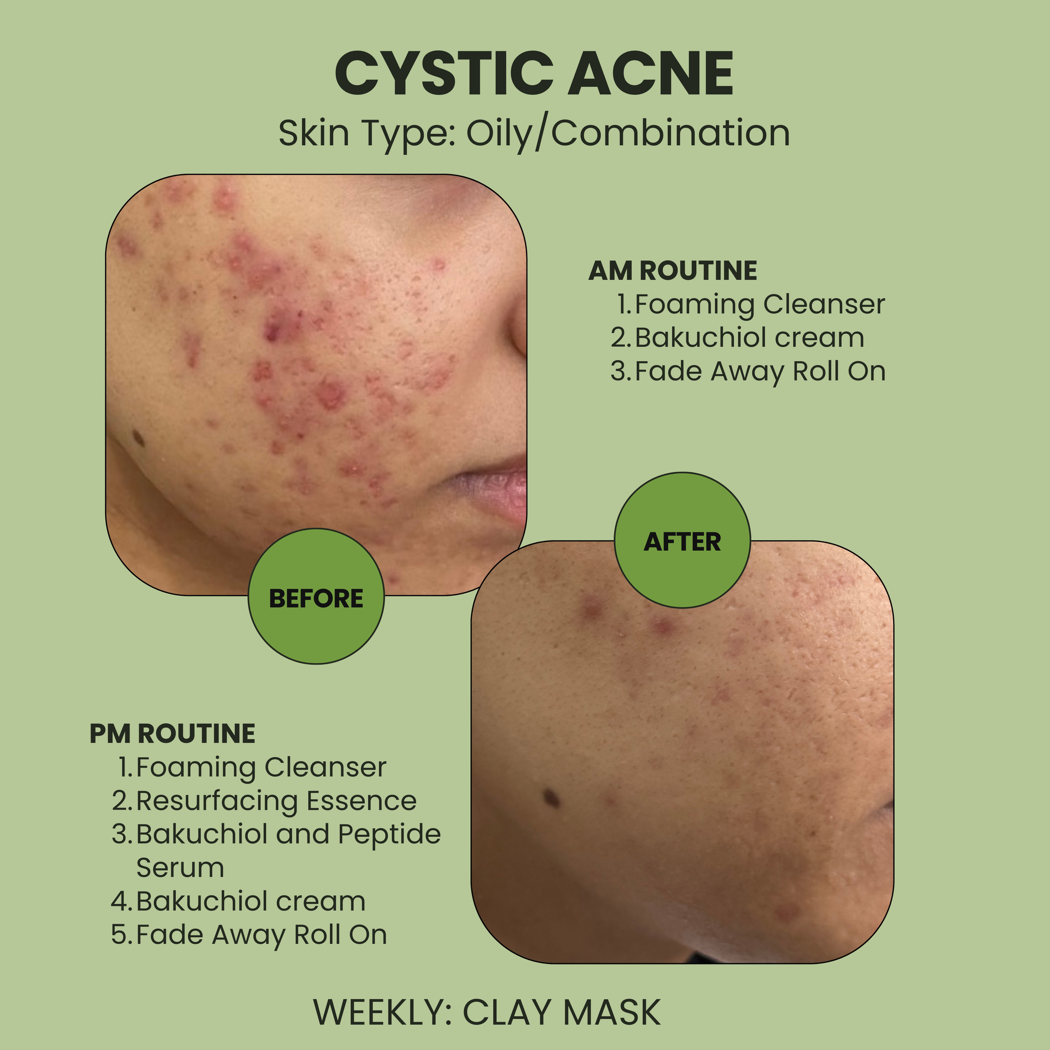 Bakuchiol and Peptide Serum