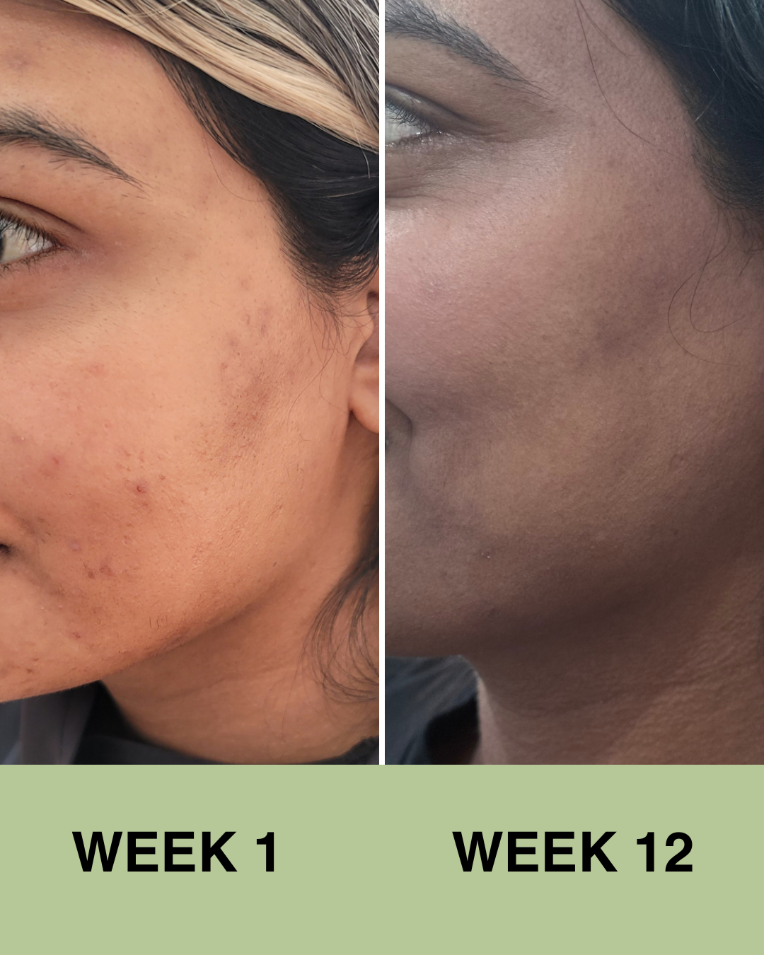 Travel Size Mini Skincare Ritual (Uneven skin tone)